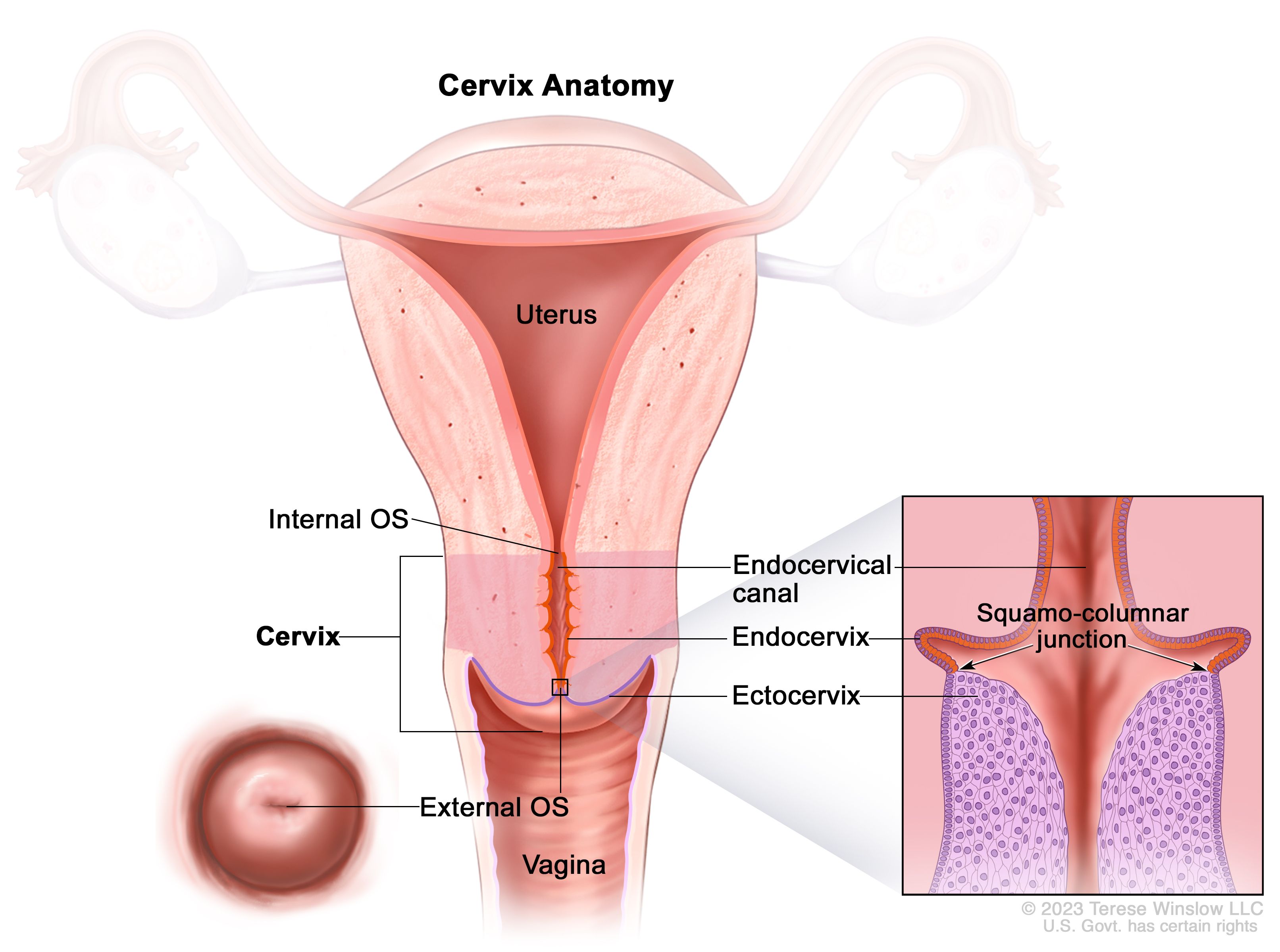 HPV (Human Papilloma Virus )